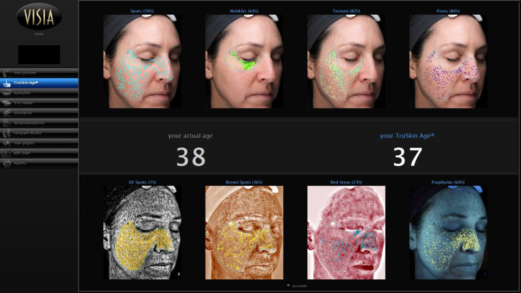 Scan After Treatment
